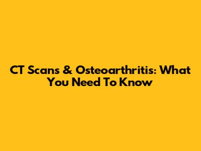 CT Scans & Osteoarthritis: What You Need To Know