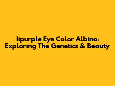Iipurple Eye Color Albino: Exploring The Genetics & Beauty